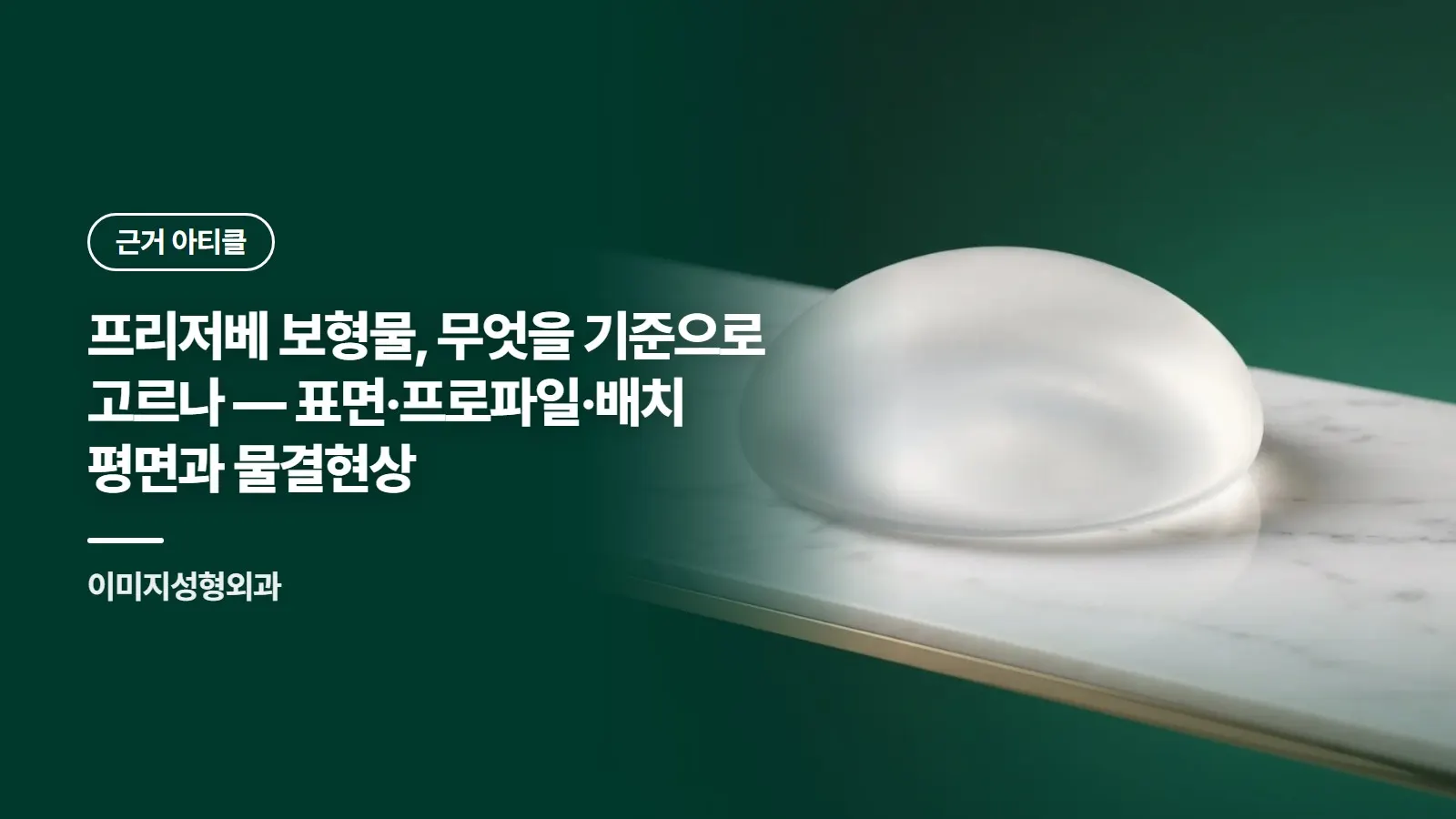 프리저베 보형물, 무엇을 기준으로 고르나 — 표면·프로파일·배치 평면과 물결현상