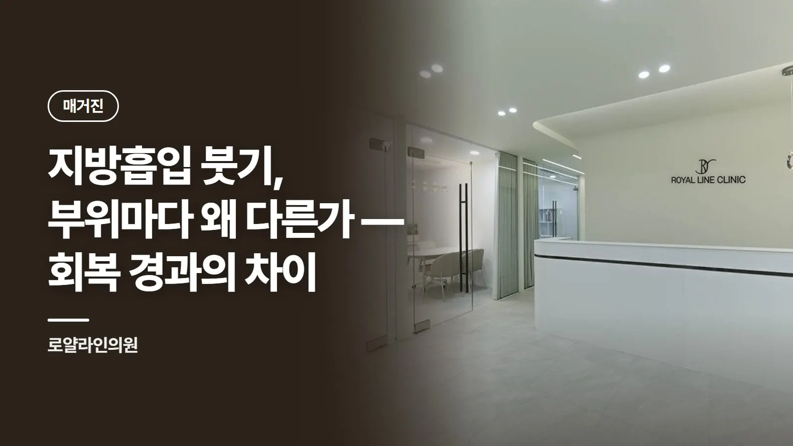 지방흡입 붓기, 부위마다 왜 다른가 — 회복 경과의 차이