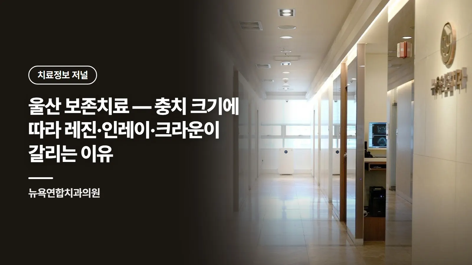 울산 보존치료 — 충치 크기에 따라 레진·인레이·크라운이 갈리는 이유