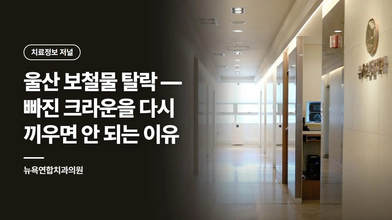 울산 보철물 탈락 — 빠진 크라운을 다시 끼우면 안 되는 이유