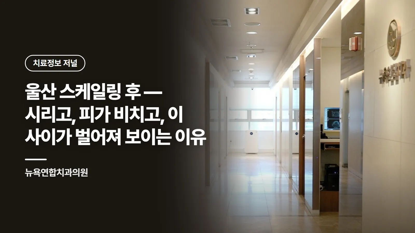 울산 스케일링 후 — 시리고, 피가 비치고, 이 사이가 벌어져 보이는 이유