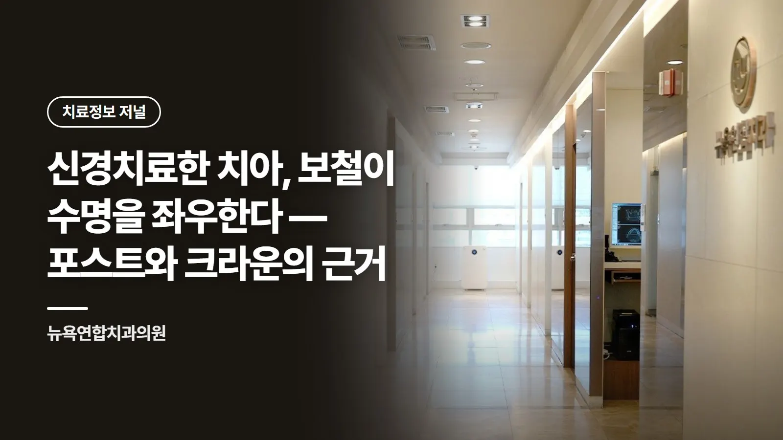 신경치료한 치아, 보철이 수명을 좌우한다 — 포스트와 크라운의 근거
