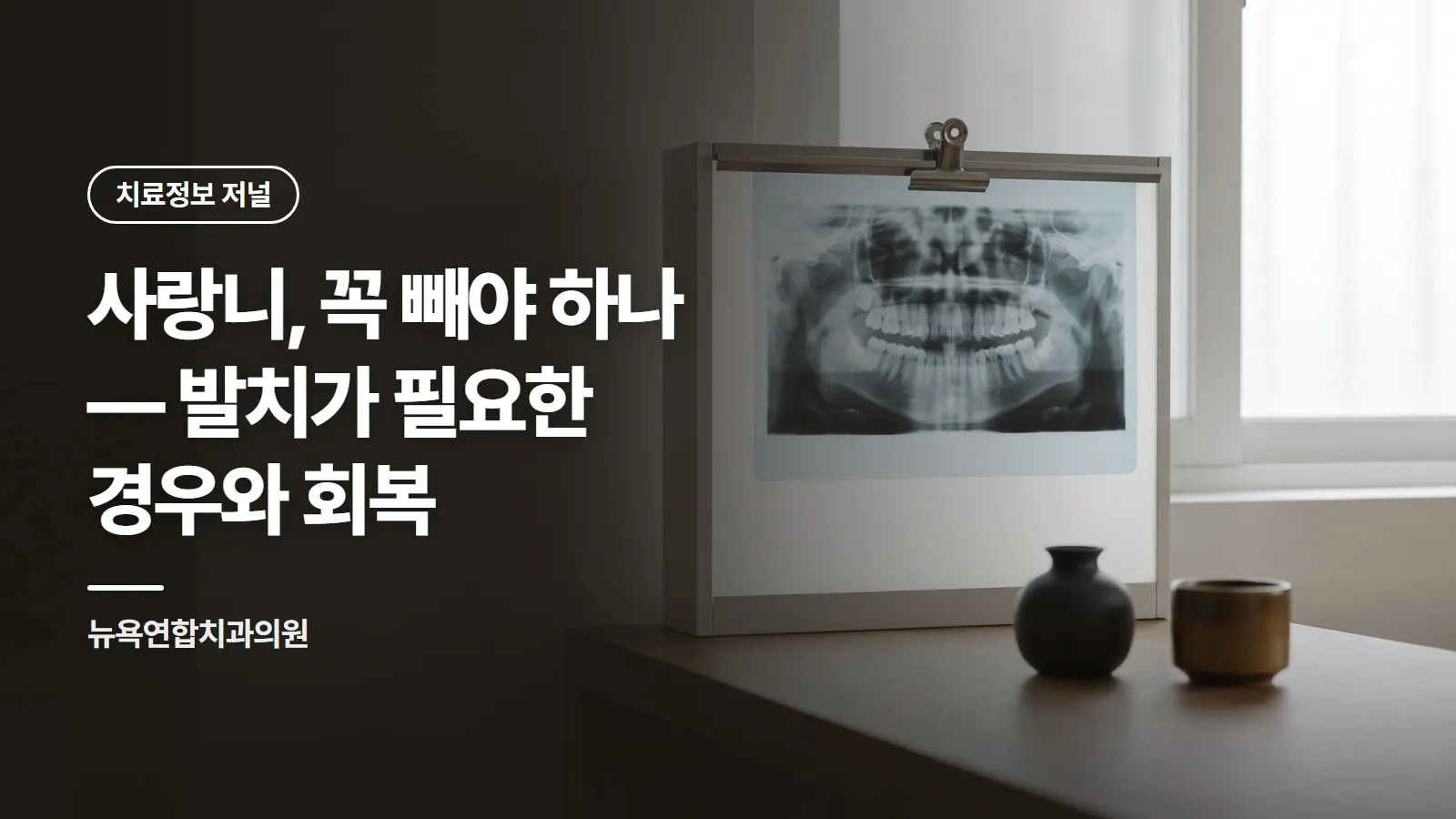 사랑니, 꼭 빼야 하나 — 발치가 필요한 경우와 회복
